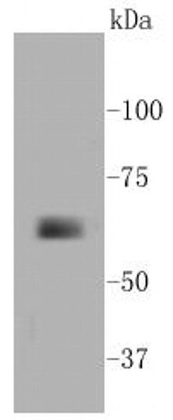 Invitrogen MMP14 Recombinant Rabbit Monoclonal Antibody (SJ18-09) 100 &mu;L;