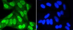 Invitrogen SUMO1 Recombinant Rabbit Monoclonal Antibody (SJ20-03) 100 &mu;L;