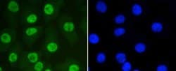 Invitrogen SUMO1 Recombinant Rabbit Monoclonal Antibody (SJ20-03) 100 &mu;L;