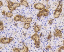 Invitrogen SUMO1 Recombinant Rabbit Monoclonal Antibody (SJ20-03) 100 &mu;L;