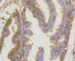 Invitrogen SUMO1 Recombinant Rabbit Monoclonal Antibody (SJ20-03) 100 &mu;L;