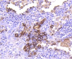 Invitrogen CD63 Recombinant Rabbit Monoclonal Antibody (SY21-02) 100 &mu;L;