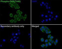 Invitrogen Phospho-PKR (Thr446) Recombinant Rabbit Monoclonal Antibody