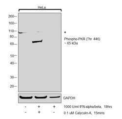 Invitrogen Phospho-PKR (Thr446) Recombinant Rabbit Monoclonal Antibody