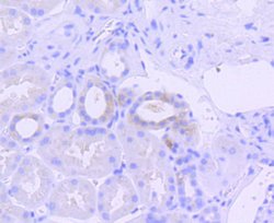 Invitrogen Phospho-PKR (Thr446) Recombinant Rabbit Monoclonal Antibody