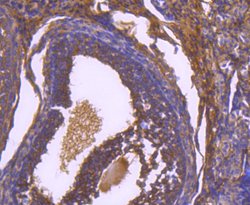 Invitrogen Paxillin Recombinant Rabbit Monoclonal Antibody (SY23-02) 100 &mu;L | Buy Online | Invitrogen&trade; | Fisher Scientific