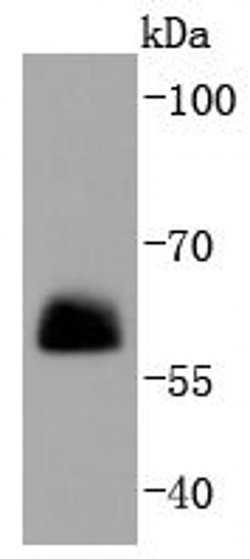 Invitrogen Paxillin Recombinant Rabbit Monoclonal Antibody (SY23-02) 100 &mu;L | Buy Online | Invitrogen&trade; | Fisher Scientific