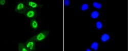 Phospho-STAT3 (Ser727) Recombinant Rabbit Monoclonal Antibody (SY24-09):Antibodies,