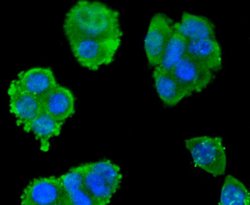 Invitrogen SMAD3 Recombinant Rabbit Monoclonal Antibody (SY25-01) 100 &mu;L;