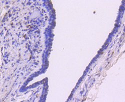 Invitrogen SMAD3 Recombinant Rabbit Monoclonal Antibody (SY25-01) 100 &mu;L;