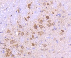 Invitrogen SMAD3 Recombinant Rabbit Monoclonal Antibody (SY25-01) 100 &mu;L;