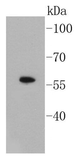 Invitrogen SMAD3 Recombinant Rabbit Monoclonal Antibody (SY25-01) 100 &mu;L;