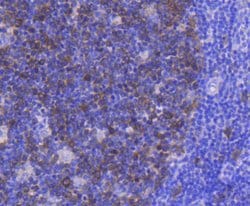 Invitrogen CDK1 Recombinant Rabbit Monoclonal Antibody (SM01-44) 100 &mu;L | Buy Online | Invitrogen&trade; | Fisher Scientific