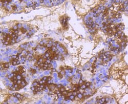Invitrogen DNAJC15 Recombinant Rabbit Monoclonal Antibody (SY26-04) 100