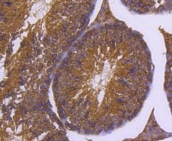 Invitrogen DNAJC15 Recombinant Rabbit Monoclonal Antibody (SY26-04) 100