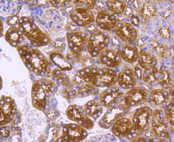 Invitrogen DNAJC15 Recombinant Rabbit Monoclonal Antibody (SY26-04) 100