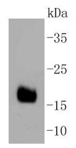 Invitrogen DNAJC15 Recombinant Rabbit Monoclonal Antibody (SY26-04) 100