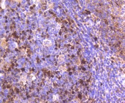 TOP2A Recombinant Rabbit Monoclonal Antibody (SY27-00), Invitrogen&trade;