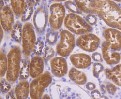 TOP2A Recombinant Rabbit Monoclonal Antibody (SY27-00), Invitrogen&trade;