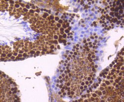 TOP2A Recombinant Rabbit Monoclonal Antibody (SY27-00), Invitrogen&trade;