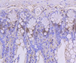 TOP2A Recombinant Rabbit Monoclonal Antibody (SY27-00), Invitrogen&trade;