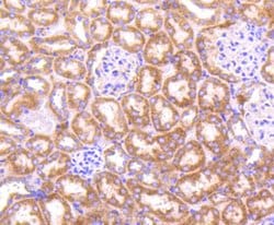 TOP2A Recombinant Rabbit Monoclonal Antibody (SY27-00), Invitrogen&trade;