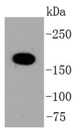 TOP2A Recombinant Rabbit Monoclonal Antibody (SY27-00), Invitrogen&trade;
