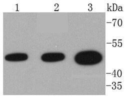 Invitrogen VASP Recombinant Rabbit Monoclonal Antibody (SY02-16) 100 &mu;L;