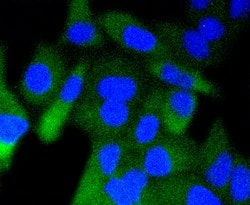 Invitrogen Phospho-GSK3B (Ser9) Recombinant Rabbit Monoclonal Antibody