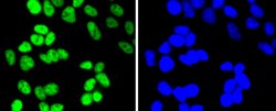 HDAC2 Recombinant Rabbit Monoclonal Antibody (SY29-02):Antibodies, Recombinant