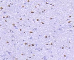 HDAC2 Recombinant Rabbit Monoclonal Antibody (SY29-02):Antibodies, Recombinant