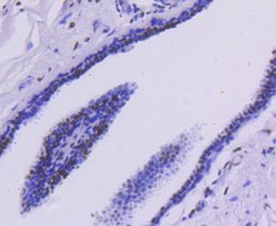 HDAC2 Recombinant Rabbit Monoclonal Antibody (SY29-02):Antibodies, Recombinant