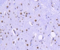 HDAC2 Recombinant Rabbit Monoclonal Antibody (SY29-02):Antibodies, Recombinant