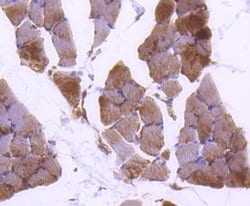 Invitrogen Plectin Recombinant Rabbit Monoclonal Antibody (SY29-04) 100