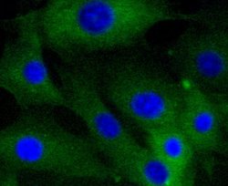 Caldesmon Recombinant Rabbit Monoclonal Antibody (SU03-19):Antibodies,