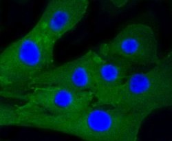 Caldesmon Recombinant Rabbit Monoclonal Antibody (SU03-19):Antibodies,