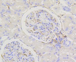 Caldesmon Recombinant Rabbit Monoclonal Antibody (SU03-19):Antibodies,
