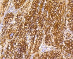 Caldesmon Recombinant Rabbit Monoclonal Antibody (SU03-19):Antibodies,