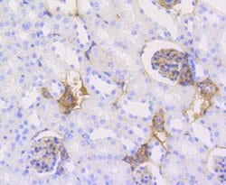 Caldesmon Recombinant Rabbit Monoclonal Antibody (SU03-19):Antibodies,