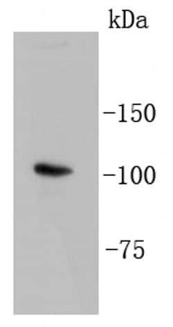 Invitrogen LGR5 Recombinant Rabbit Monoclonal Antibody (SU32-04) 100 &mu;L | Buy Online | Invitrogen&trade; | Fisher Scientific