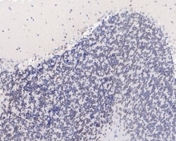 ELK1 Recombinant Rabbit Monoclonal Antibody (SU32-05):Antibodies, Recombinant