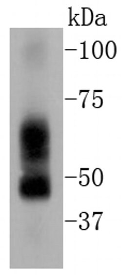 ELK1 Recombinant Rabbit Monoclonal Antibody (SU32-05):Antibodies, Recombinant