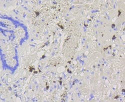 Invitrogen ABCG1 Recombinant Rabbit Monoclonal Antibody (SU03-26) 100 &mu;L;