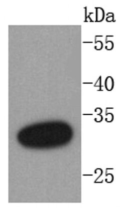 Invitrogen DARPP-32 Recombinant Rabbit Monoclonal Antibody (SU0329) 100