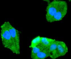 Invitrogen FOXO1 Recombinant Rabbit Monoclonal Antibody (SU33-01) 100 &mu;L;