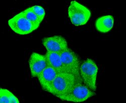 Invitrogen FOXO1 Recombinant Rabbit Monoclonal Antibody (SU33-01) 100 &mu;L;