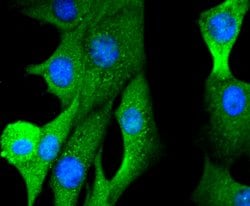 Invitrogen FOXO1 Recombinant Rabbit Monoclonal Antibody (SU33-01) 100 &mu;L;