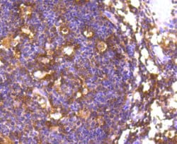 Invitrogen FOXO1 Recombinant Rabbit Monoclonal Antibody (SU33-01) 100 &mu;L;