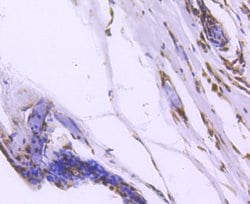Invitrogen FOXO1 Recombinant Rabbit Monoclonal Antibody (SU33-01) 100 &mu;L;