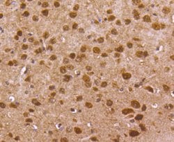 Invitrogen FOXO1 Recombinant Rabbit Monoclonal Antibody (SU33-01) 100 &mu;L;